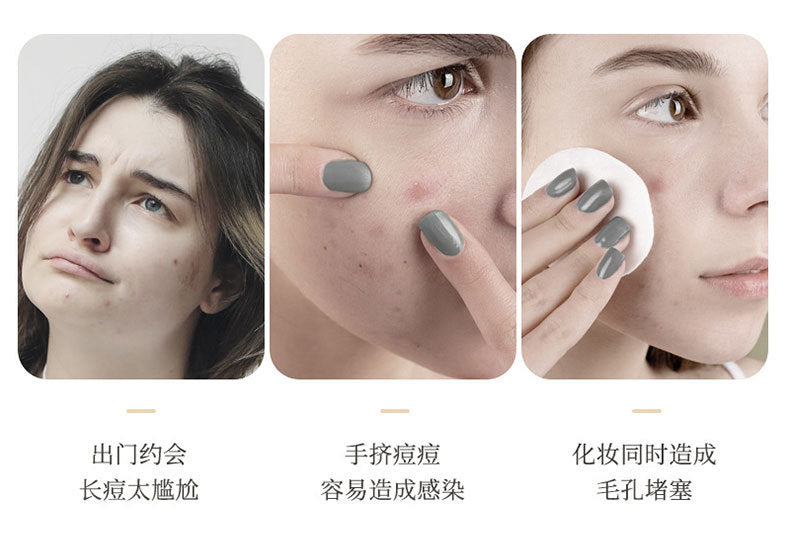 Star Color Student Acne Colloid Cute Dopamine Anti